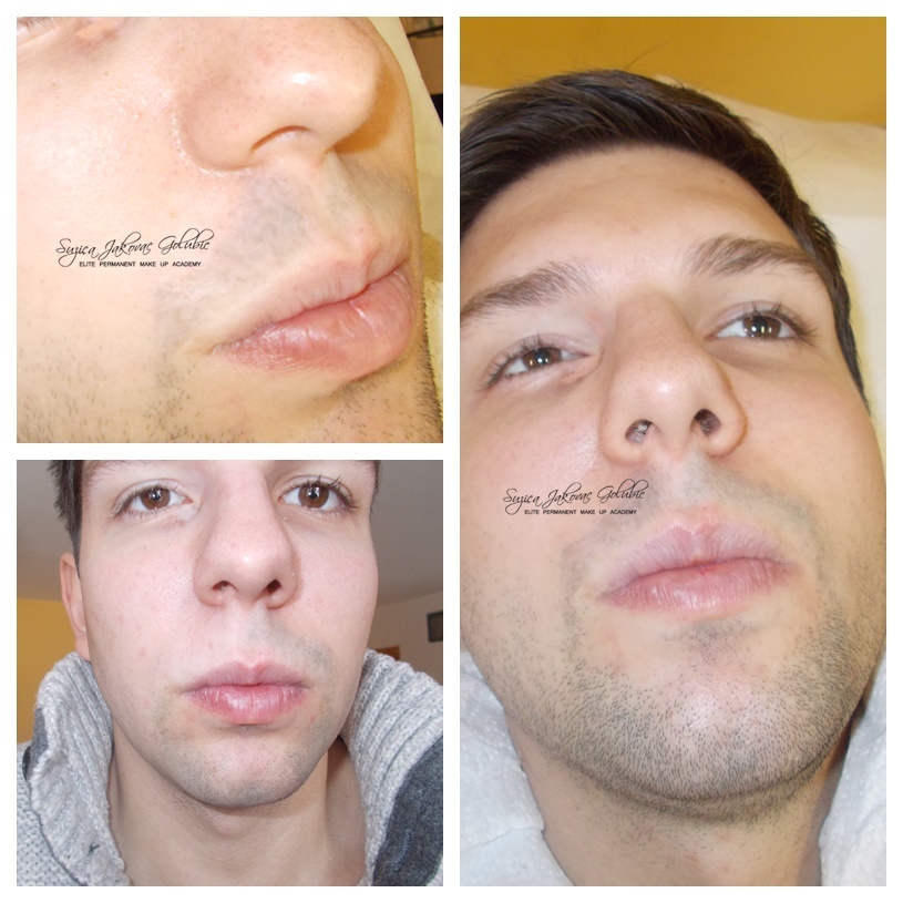 Estetski Medicinski tretman