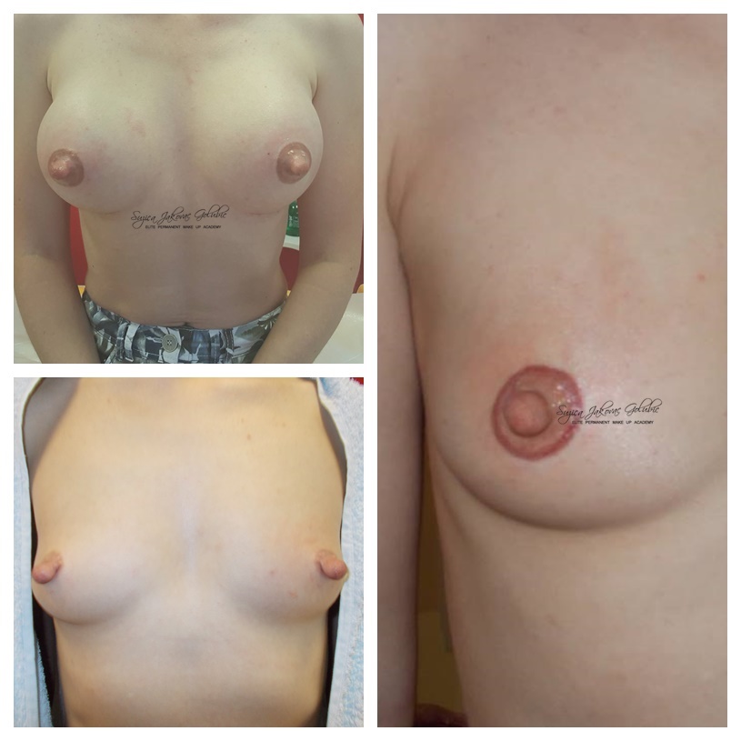 Estetski Medicinski tretman