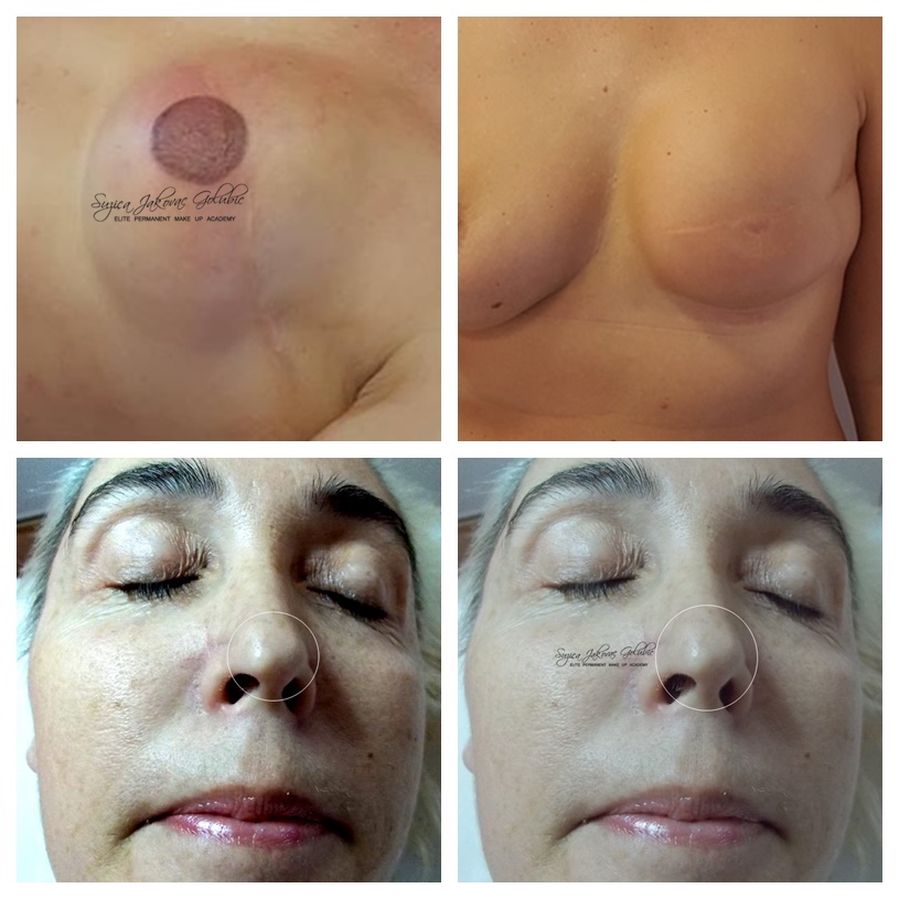 Estetski Medicinski tretman