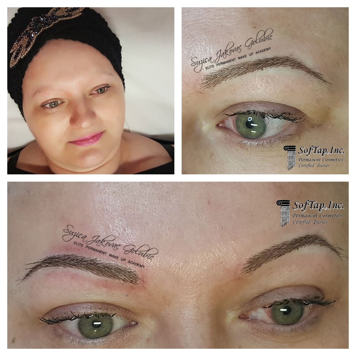 Super prirodne obrve - poslije totalne alopecije